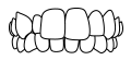 교차교합